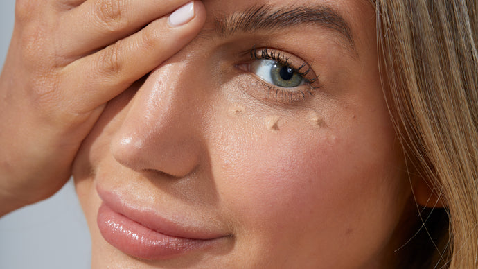 HOW TO GET RID OF UNDEREYE BAGS
