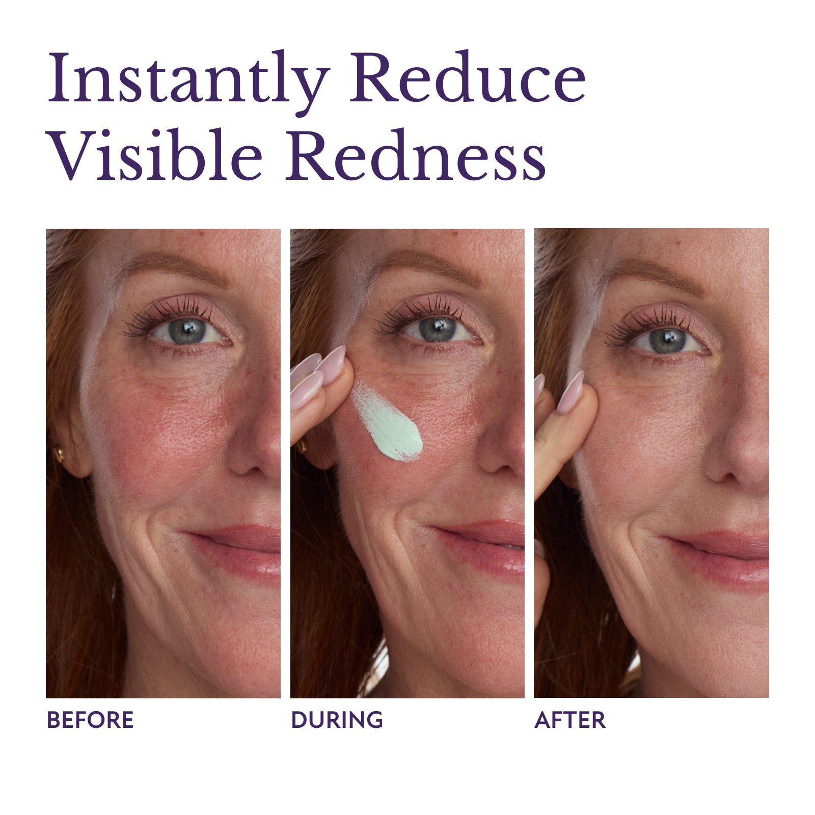 Edición de zona roja