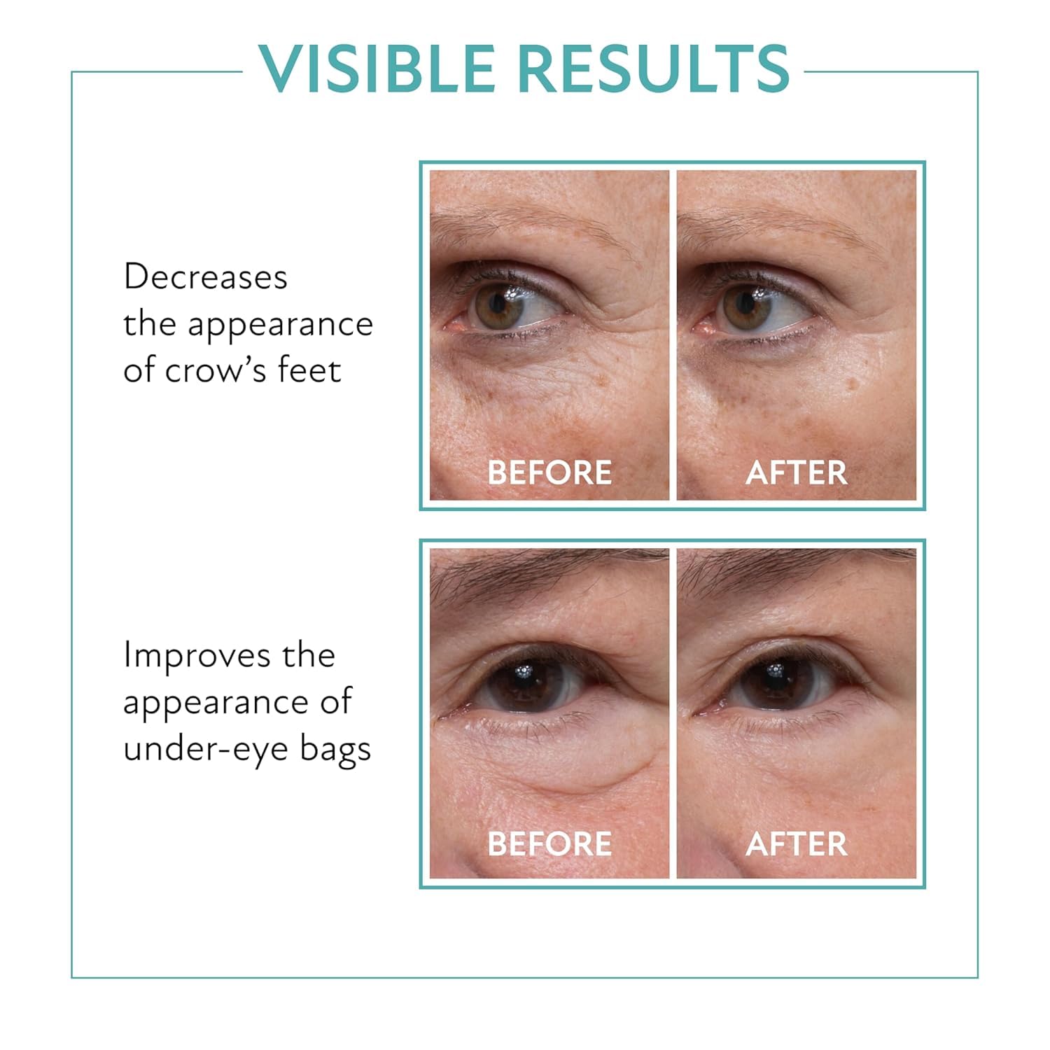 Instant Eye Lift Duo