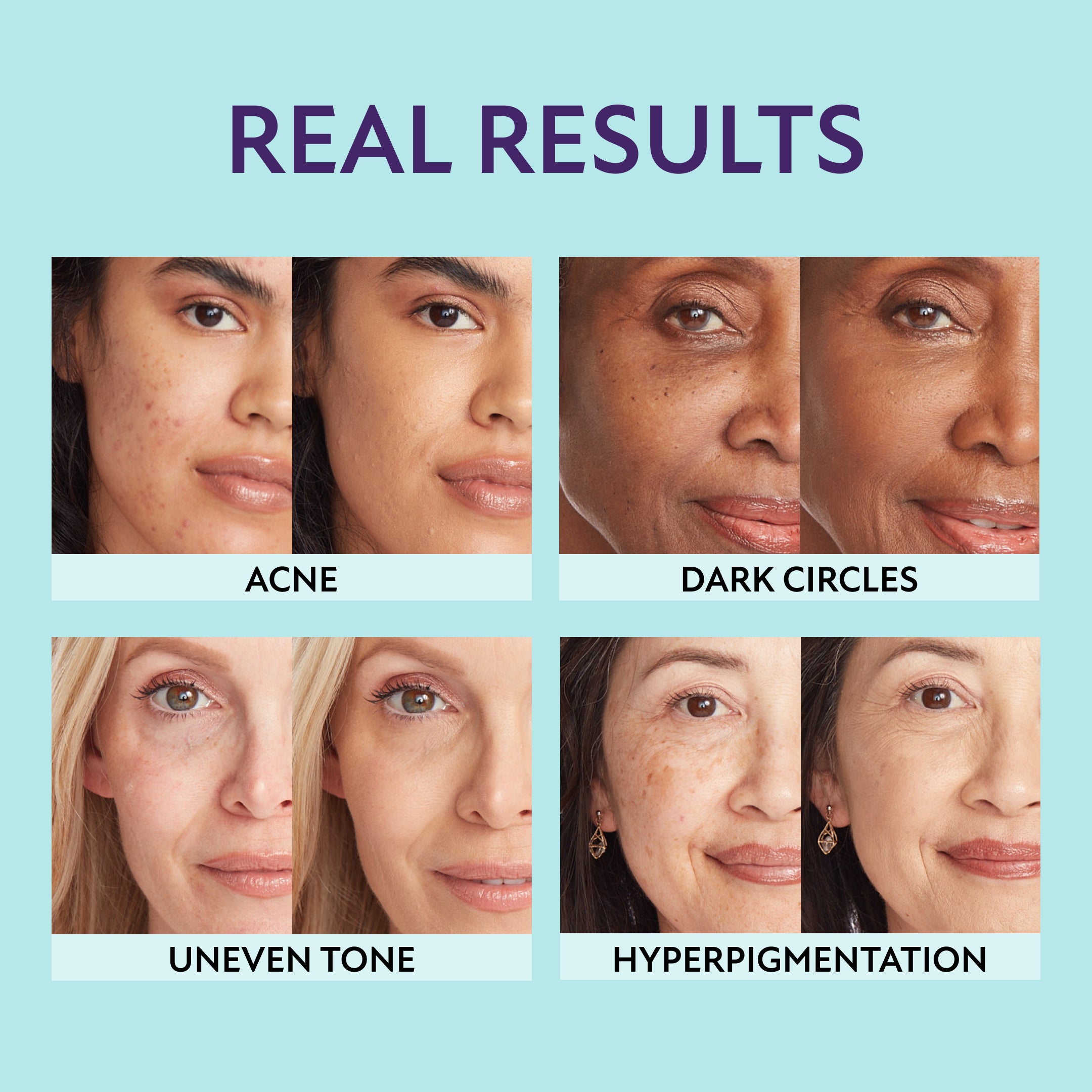 Supreme Complexion Set