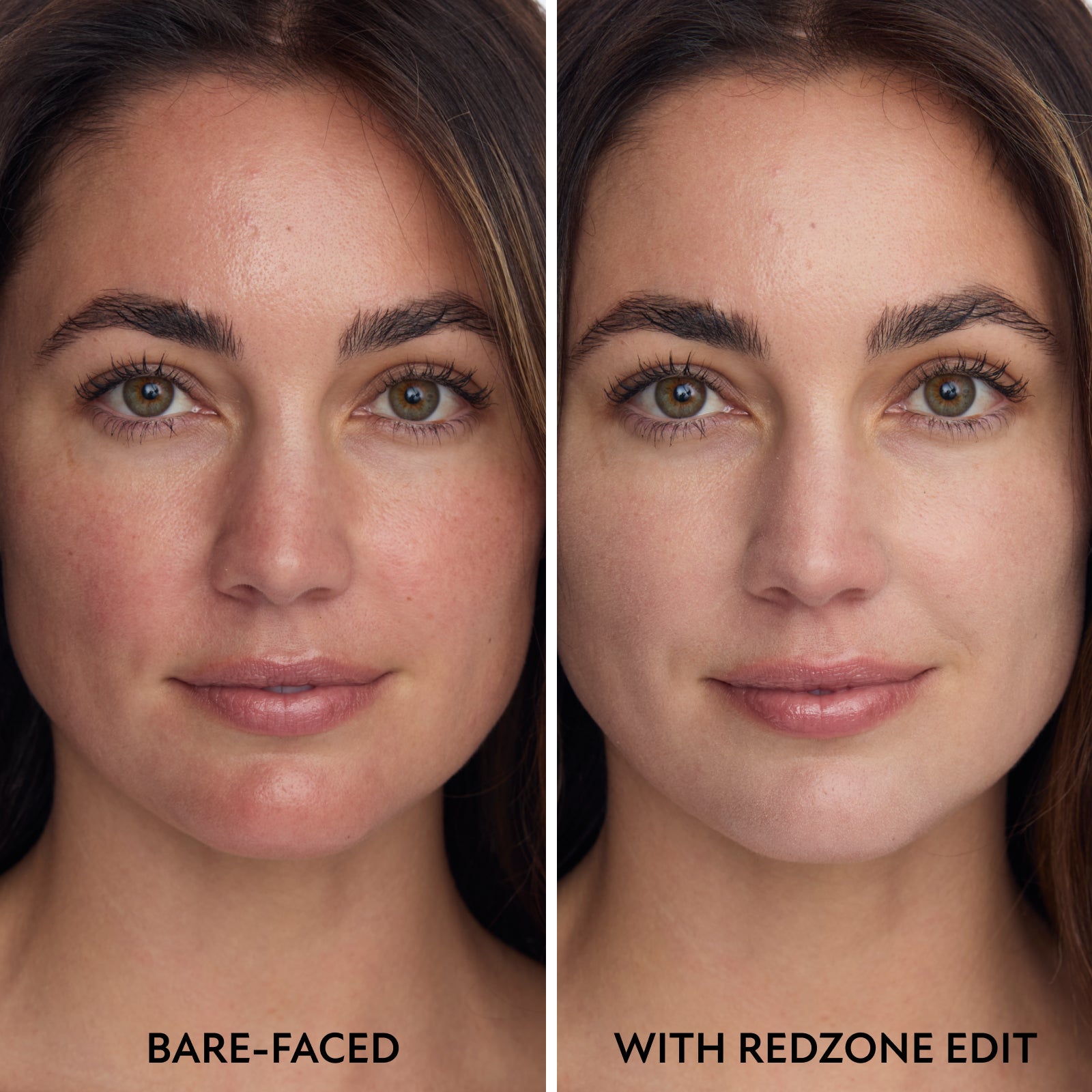 Edición de zona roja