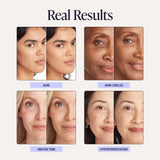 Supreme Creme conceals skin imperfections